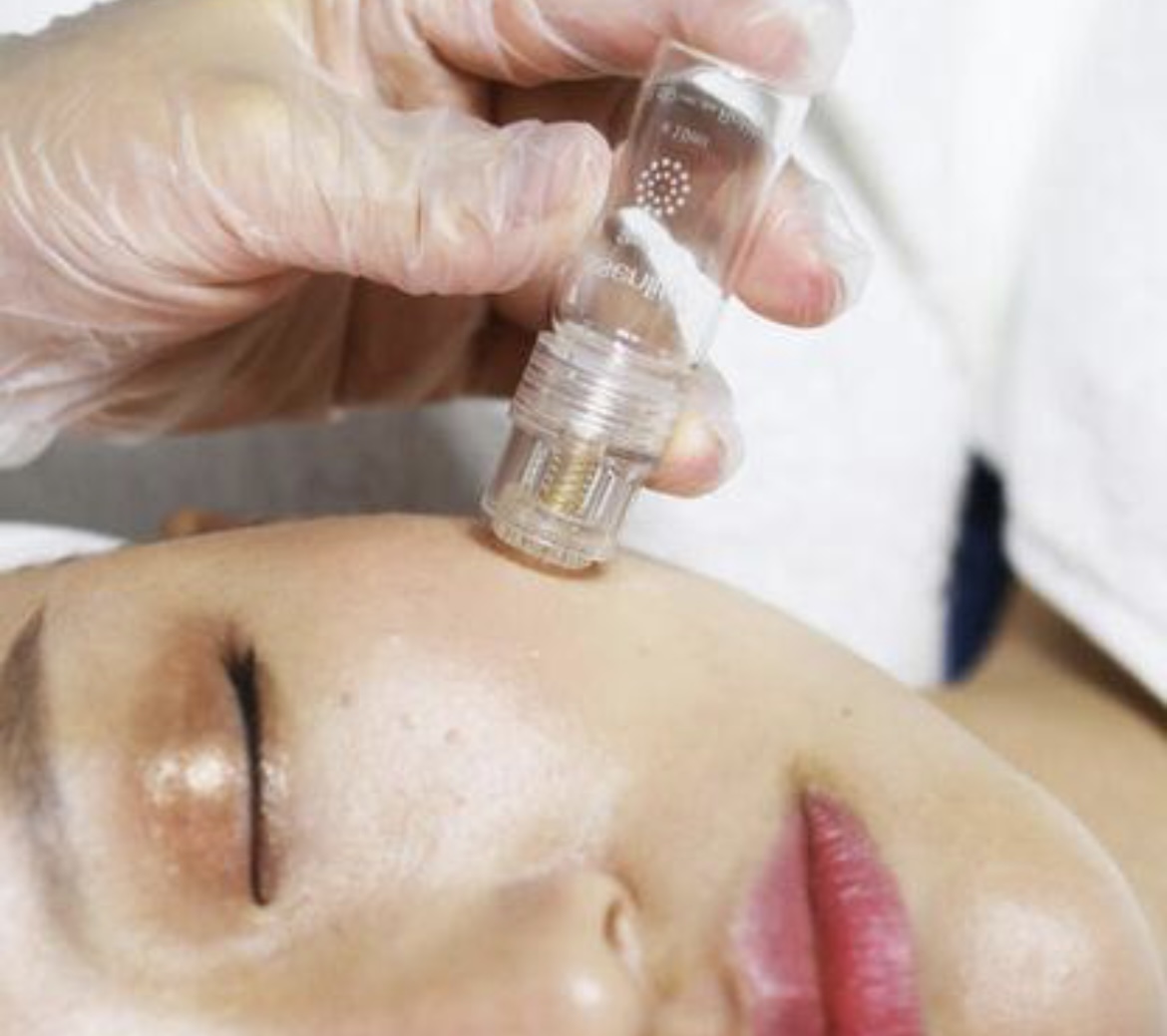 Micro infusion Facial Revive Refresh